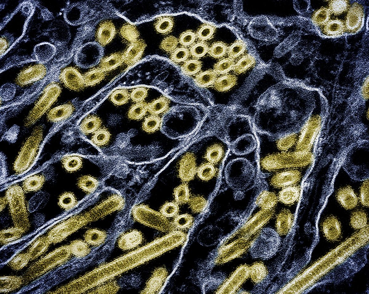 This colorized transmission electron micrograph shows avian influenza A H5N1 virus particles.